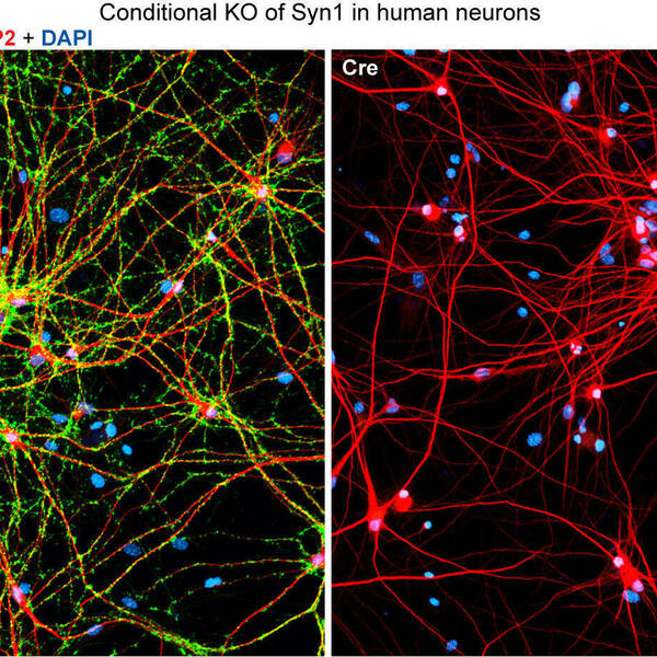 Human Syn1 Knock Out Neurons